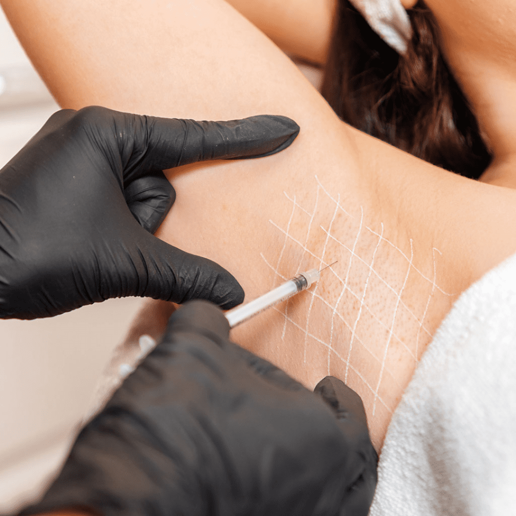 Under Arm Sweat Treatment