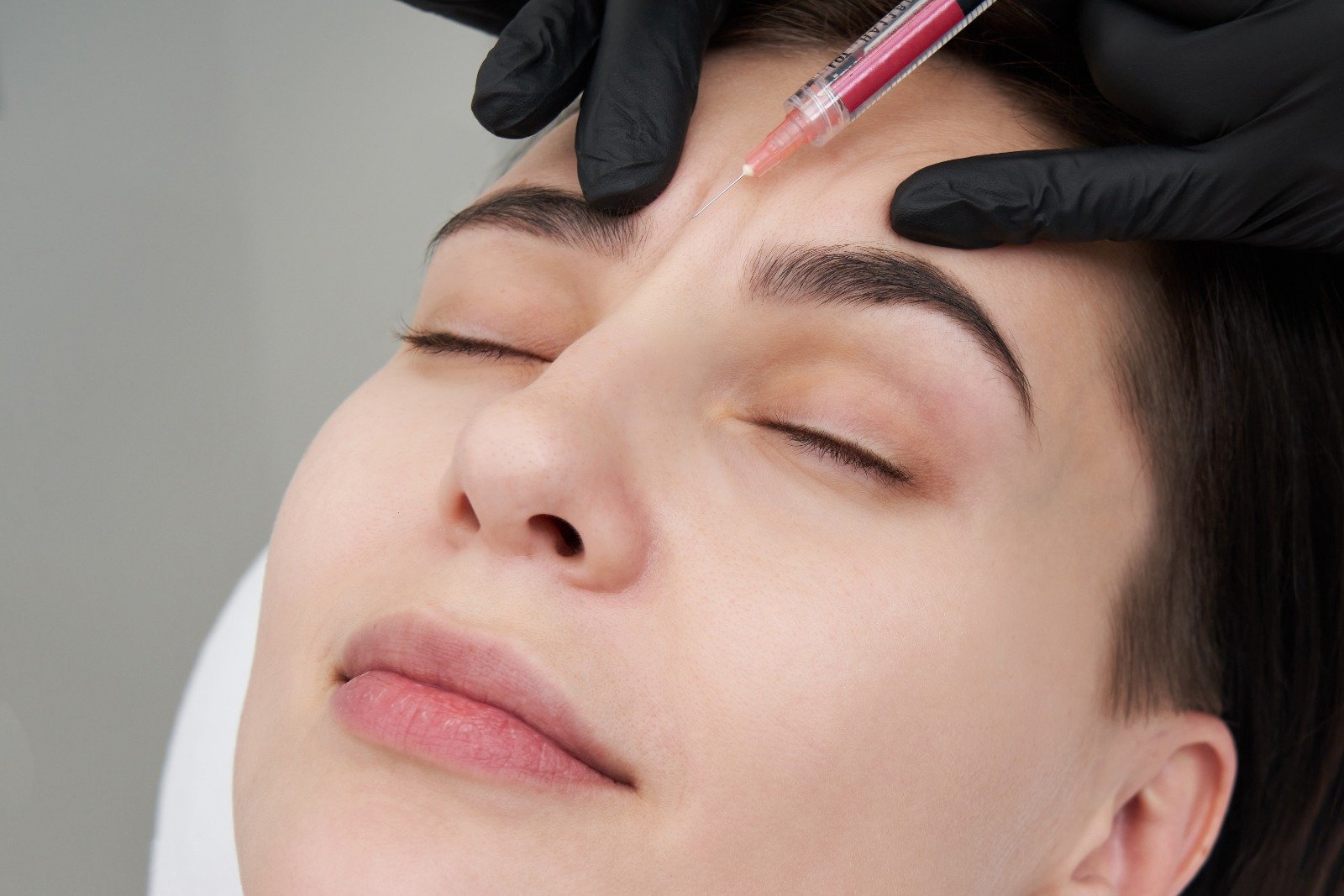 Brow Lift Botox