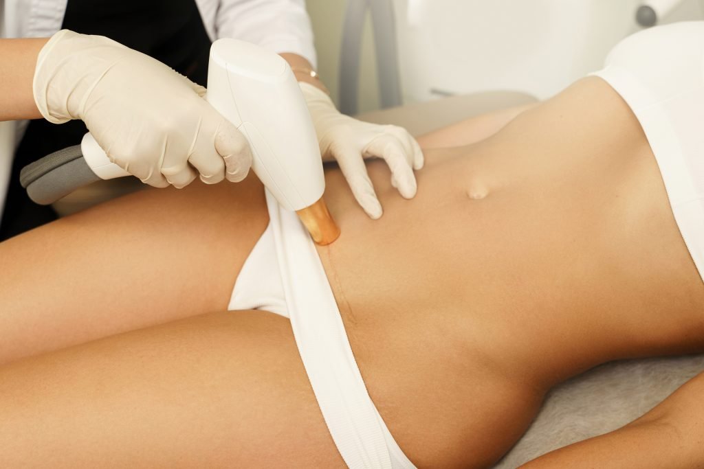 Large Areas Laser Hair Removal