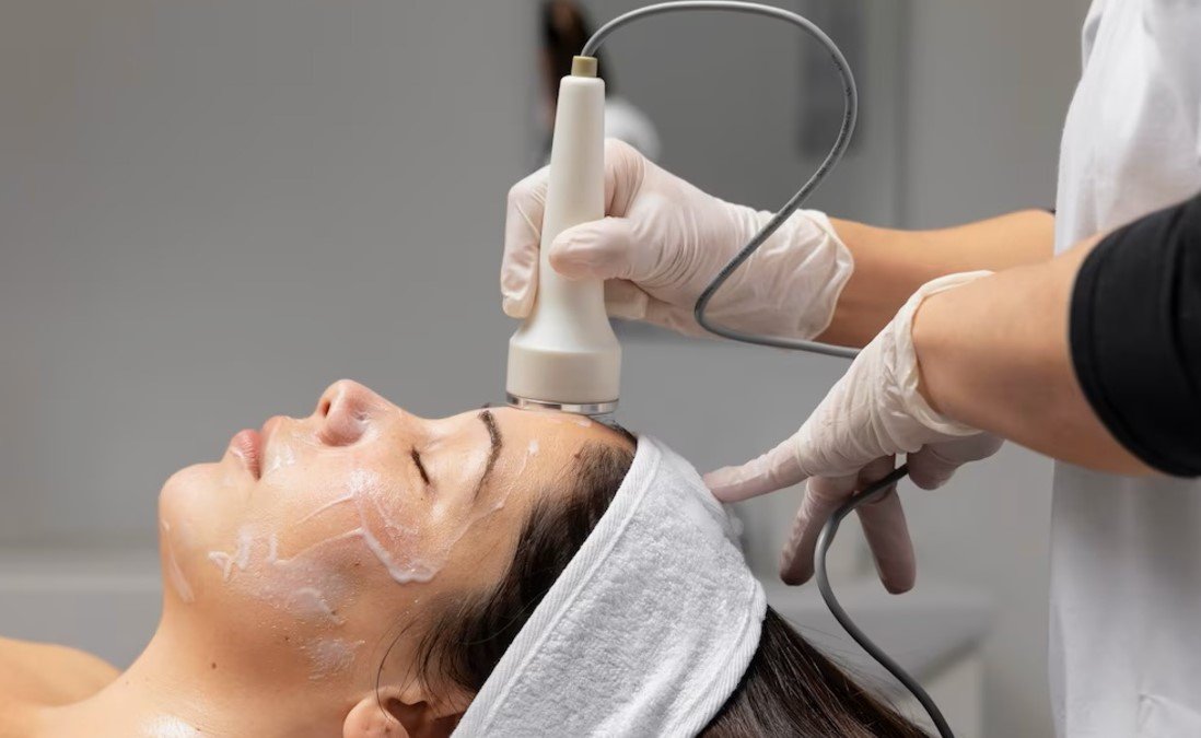 Plasma Pen Skin Tag Removal