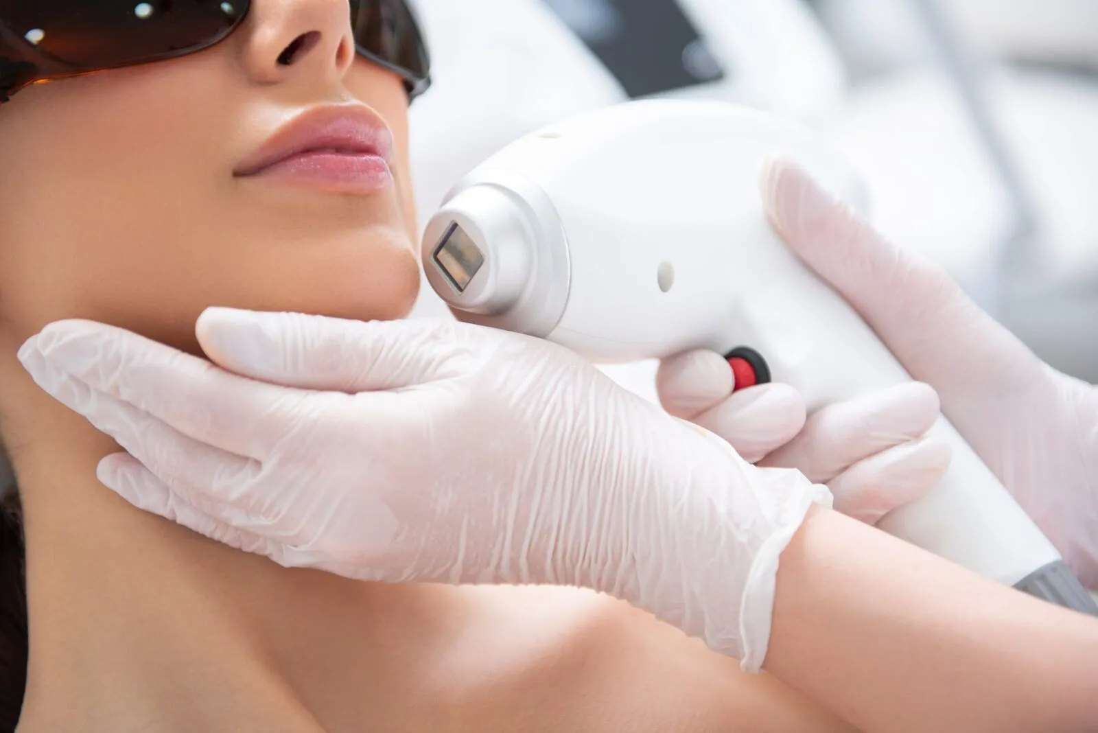 Laser Skin Rejuvenation