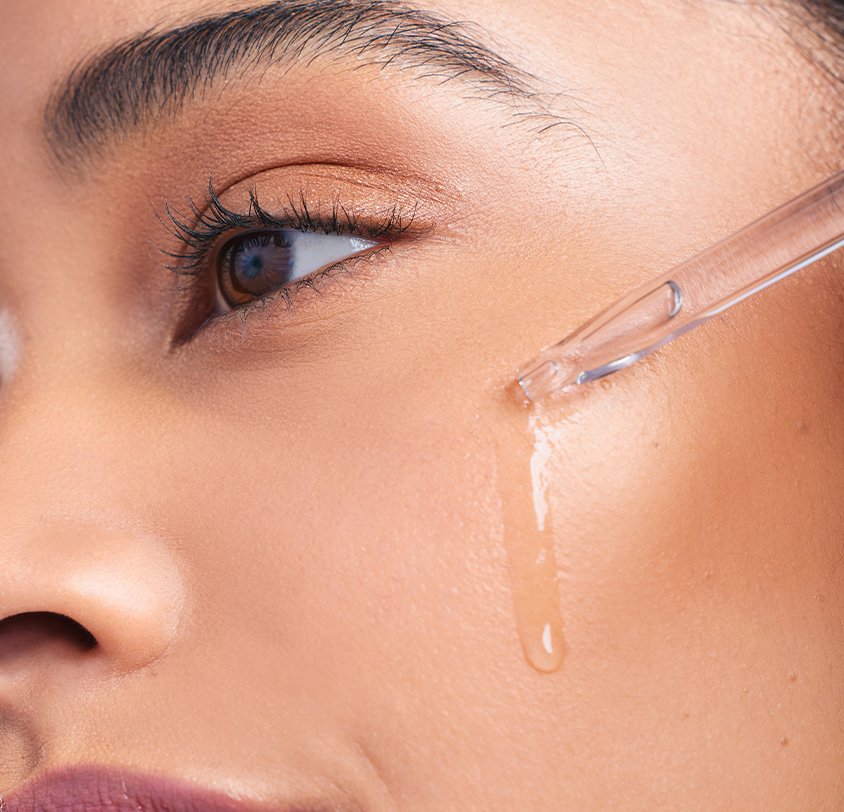 Microneedling with HA